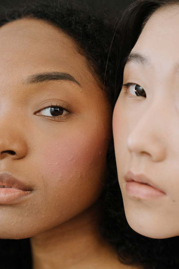 chemical-peel-facial-spa-winter-park-florida
